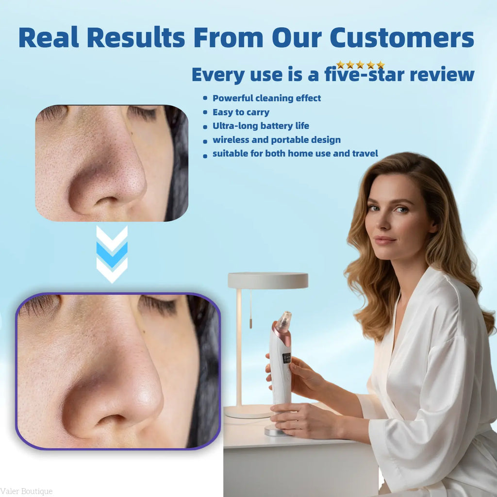 Blackhead Remover Pore Vacuum USB Rechargeable Blackhead Extractor Facial Beauty Instrument Facial Beauty Facial Cleaner Electric Acne Removal Tool